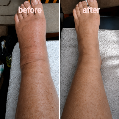 6-in-1 Lymphatic & Fluid Balance